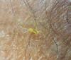 Philodromus sp.